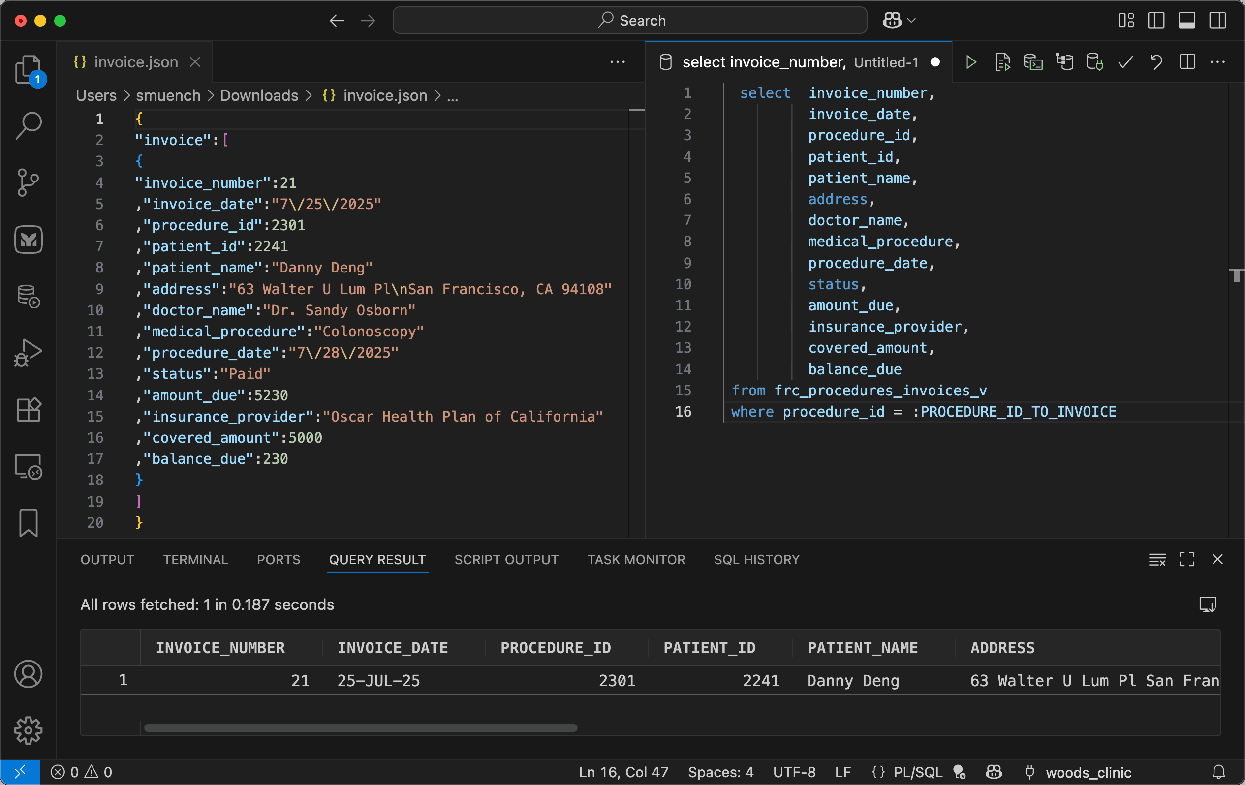 Studying Report Query JSON and Testing Query in VS Code